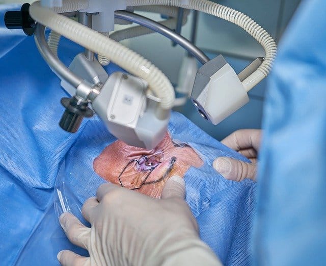 Looking for Sydney’s Most Affordable Laser Eye Treatment