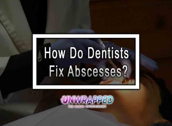How Do Dentists Fix Abscesses?