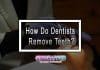 How Do Dentists Remove Teeth?