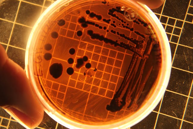 Bacterial Nanowires